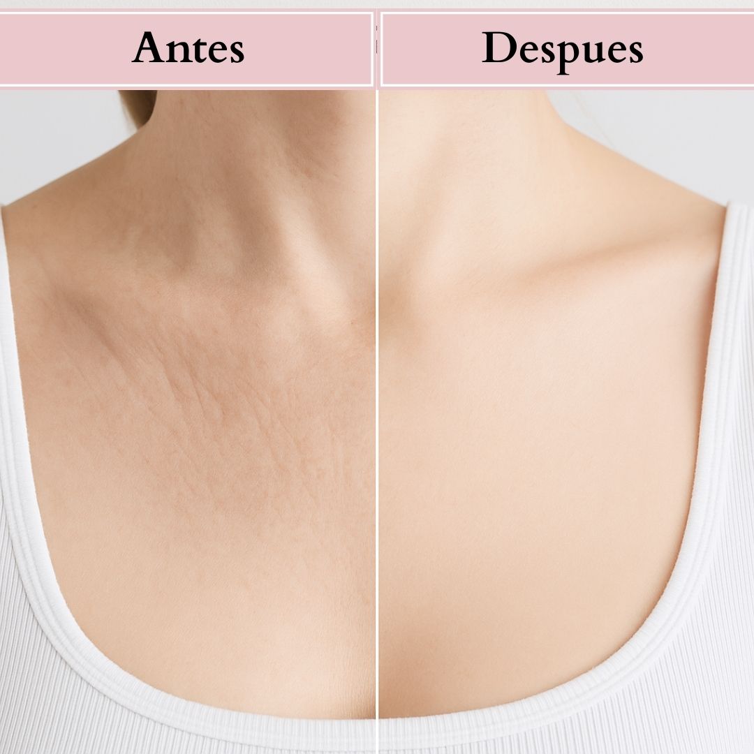 Anti-Wrinkle Cleavage Bra - Lune Rouge